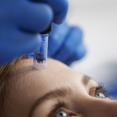 MEZOTERAPIA MIKROIGŁOWA - Skuteczny zabieg odmładzający, ujędrniający oraz widocznie wygładzający i rozświetlający skórę twarzy. Mezoterapia mikroigłowa jest jednym z najskuteczniejszych zabiegów anty aging w medycynie estetycznej. Polecamy!