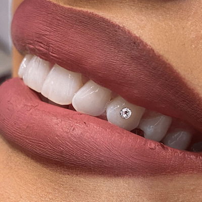 TOOTH GEMS - Błyszczący Uśmiech z Biżuterią Nazębną Swarovski. Zamień swój uśmiech w prawdziwe dzieło sztuki! Nasza biżuteria nazębna z kryształkami Swarovskiego to idealny sposób na wyrażenie swojego stylu i unikalności.