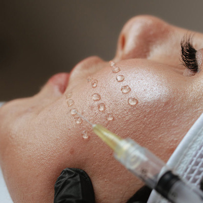 MEZOTERAPIA IGŁOWA Z PEPTYDAMI 10 %  na twarz, szyję oraz dekolt - Najskuteczniejsza metoda rewitalizacji, regeneracji i odmłodzenia skóry. Dzięki niej pozbędziesz się zmarszczek i wygładzisz skórę twarzy po 1 zabiegu! 