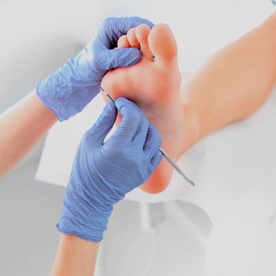 PEDICURE MEDYCZNY - Profesjonalny pedicure medyczny z kompleksowym opracowaniem paznokci – zadbaj o zdrowie i komfort swoich stóp z pomocą dyplomowanego podologa!