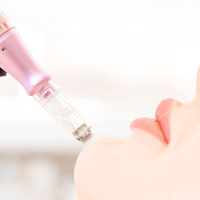 MEZOTERAPIA MIKROIGŁOWA 3w1 - Kompleksowa regeneracja Twojej skóry!