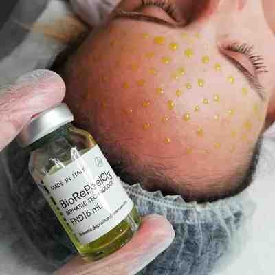 BIOREPEEL + OCZYSZCZANIE WODOROWE: Oczyszczenie, rozjaśnienie i redukcja zmarszczek już po 1 zabiegu! Oferta limitowana!