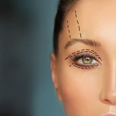 DERMAPEN NA OKOLICE OCZU: młodsze spojrzenie, mniej zmarszczek i cieni – limitowana oferta!