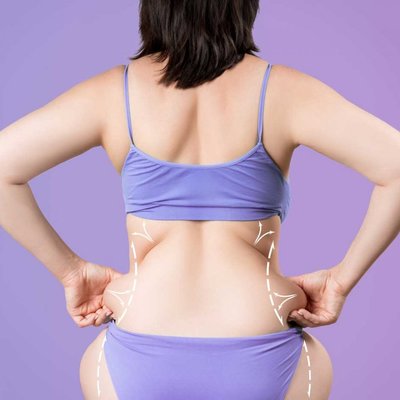 KRIOLIPOLIZA + ELEKTROSTYMULACJA: skuteczne spalanie tłuszczu i modelowanie sylwetki w jednym zabiegu.