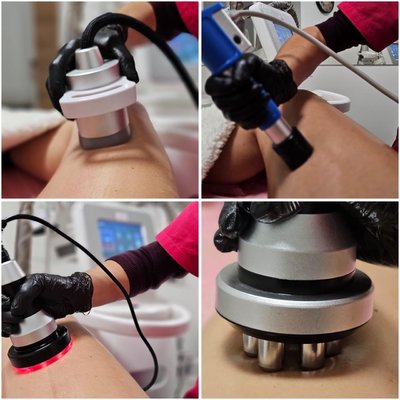 ZABIEG 4W1 NA WYBRANĄ PARTIĘ CIAŁA: intensywne modelowanie i wygładzenie skóry.