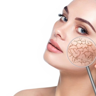 ZAMYKANIE NACZYNEK LASEREM DIODOWYM: gładka, spokojna skóra bez pajączków – efekt widoczny od razu.