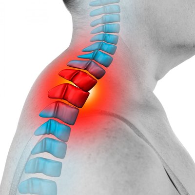 REDUKCJA WDOWIEGO GARBU: wyprostowana sylwetka, lżejszy kark i widoczna poprawa postawy już po pierwszych zabiegach.