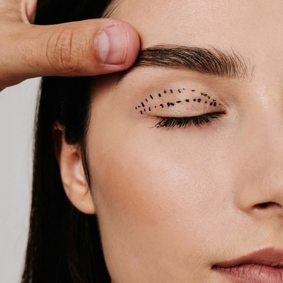 BLEFAROPLASTYKA NIECHIRURGICZNA POWIEK (PLAZMA): uniesienie opadającej powieki i wygładzenie skóry – efekt liftingu widoczny już po zabiegu.