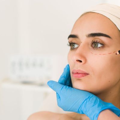 REDUKCJA WORKÓW POD OCZAMI RF: wygładzenie, napięcie i bardziej wypoczęte spojrzenie już po jednej wizycie.